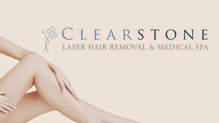 12888 clearstone laser hair removal med spa 768x431