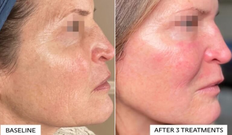 12985 hana clinic medspa 768x449